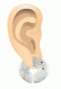 图片:邯郸状耳饰的形象